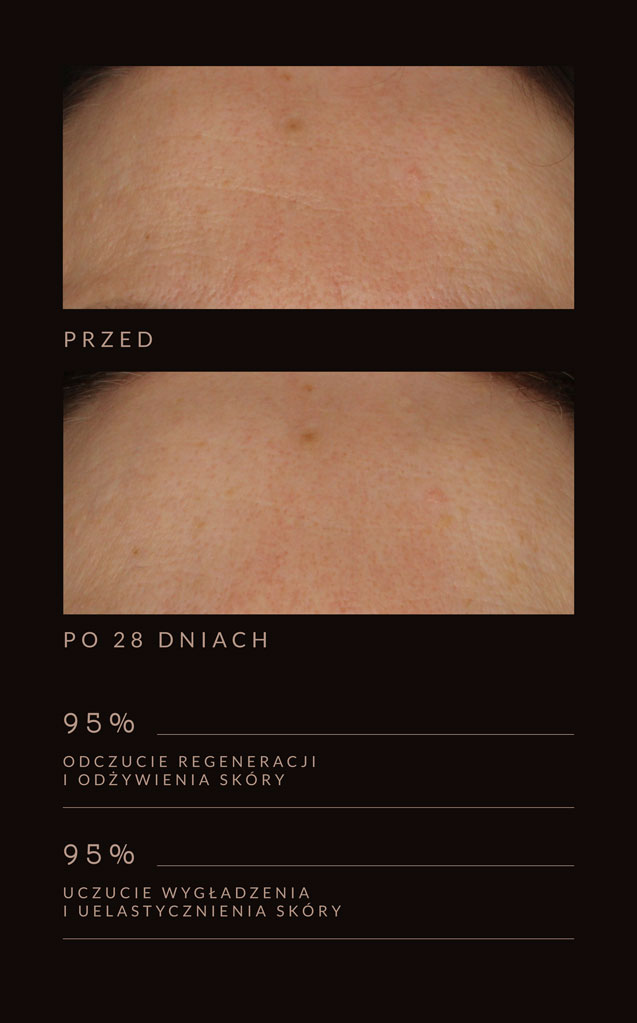 efekty stosowania kosmetyków naturalnych Tierra Natural